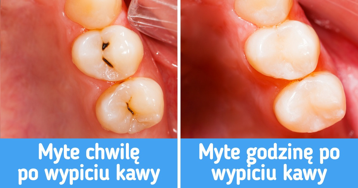 7 porad na uzyskanie białych i zdrowych zębów