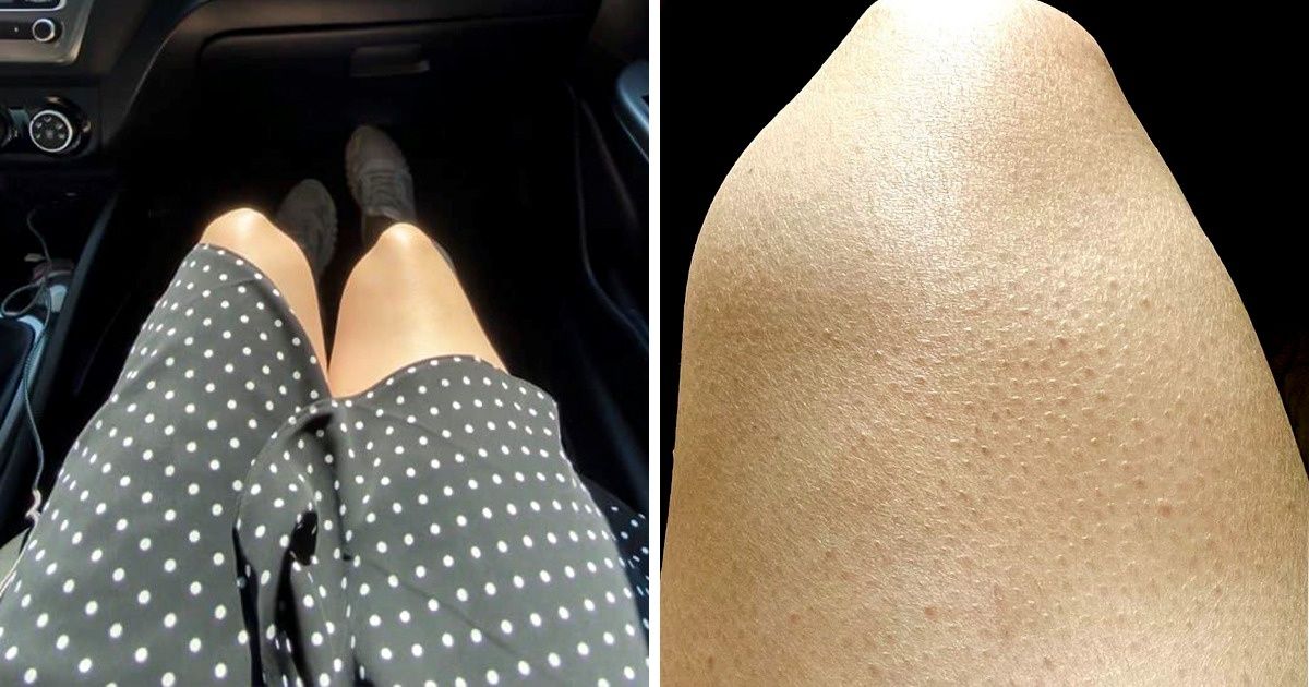 9 cech kobiecego wyglądu, które bez powodu uważane są za wady
