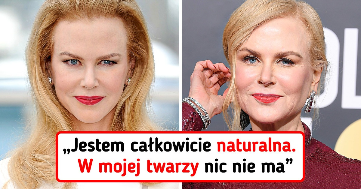 8 znanych kobiet, które zarzekają się, że ich piękno jest naturalne, a my nie możemy przestać ich podziwiać