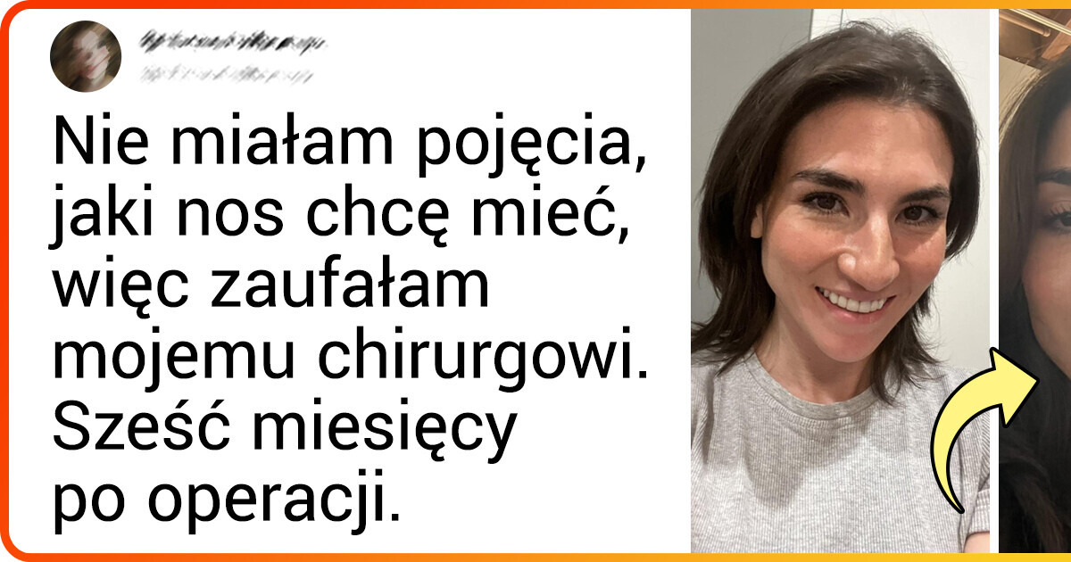 16 porównań zdjęć pokazujących zaskakującą różnicę 16 porównań zdjęć pokazujących zaskakującą różnicę