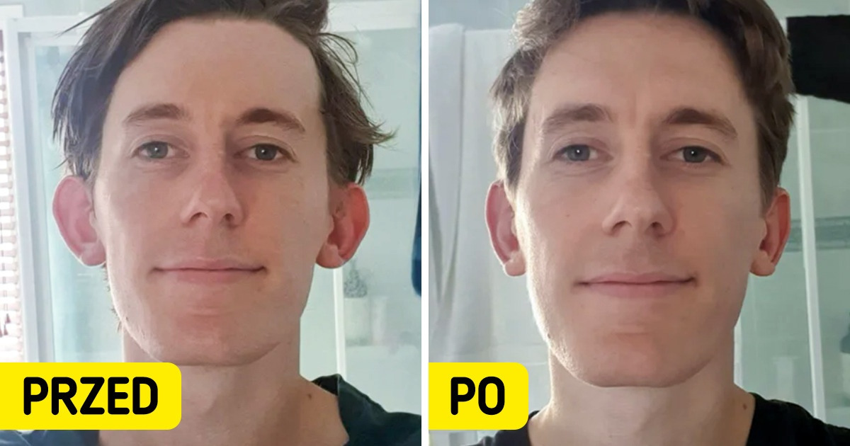 15 osób, które zdecydowały się na operację plastyczną i czują z tego powodu wdzięczność