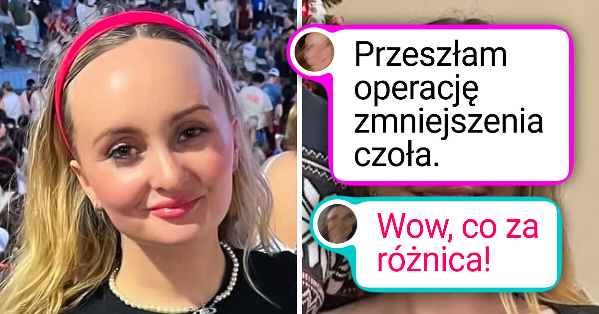 15 osób, które w krótkim czasie zmieniły się nie do poznania