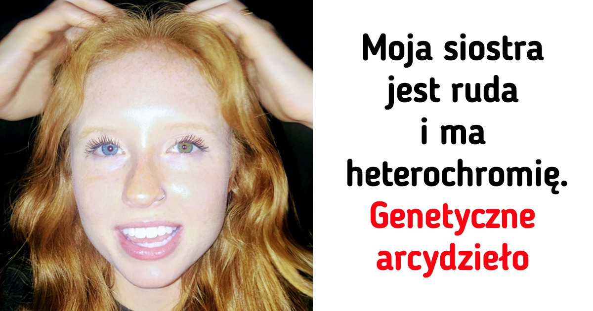 15 osób z rzadkimi cechami, które są ich wielkim powodem do dumy
