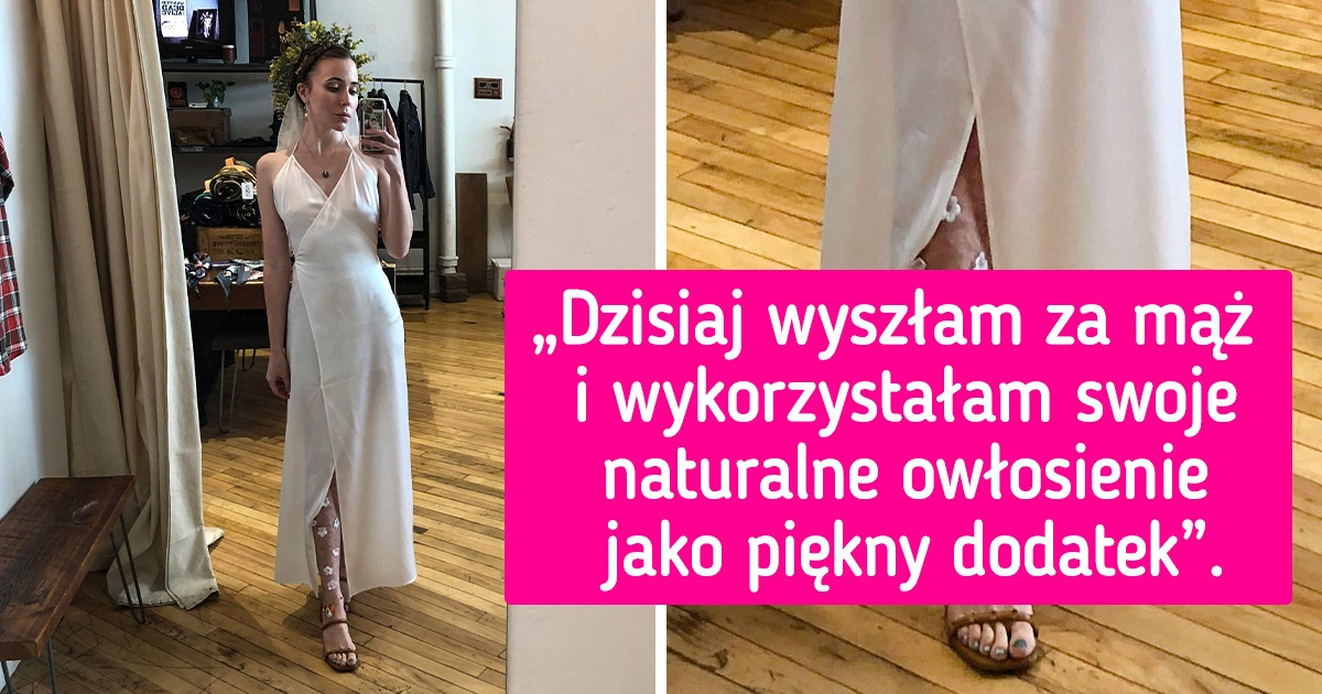 17 kobiet, które przestały się golić, stawiając na wyzwolenie