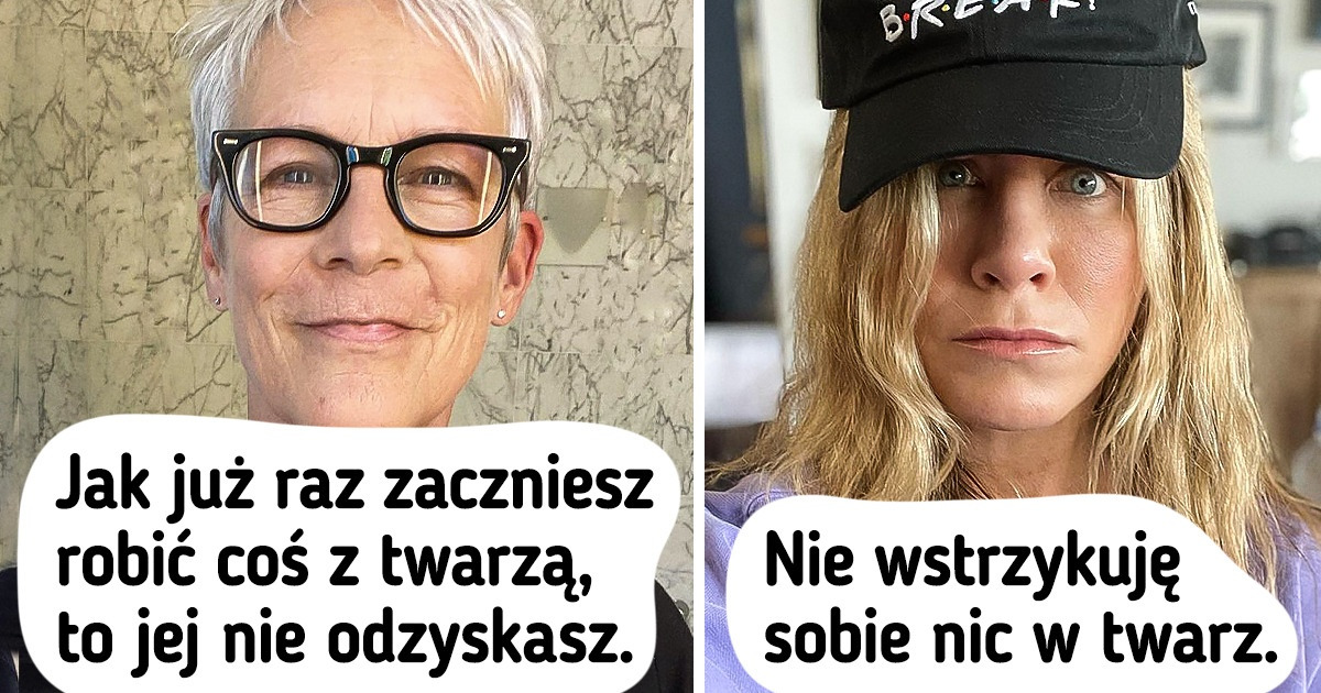10 gwiazd, które wyraziły swój sprzeciw wobec operacji plastycznych, a my pochwalamy ich szczerość