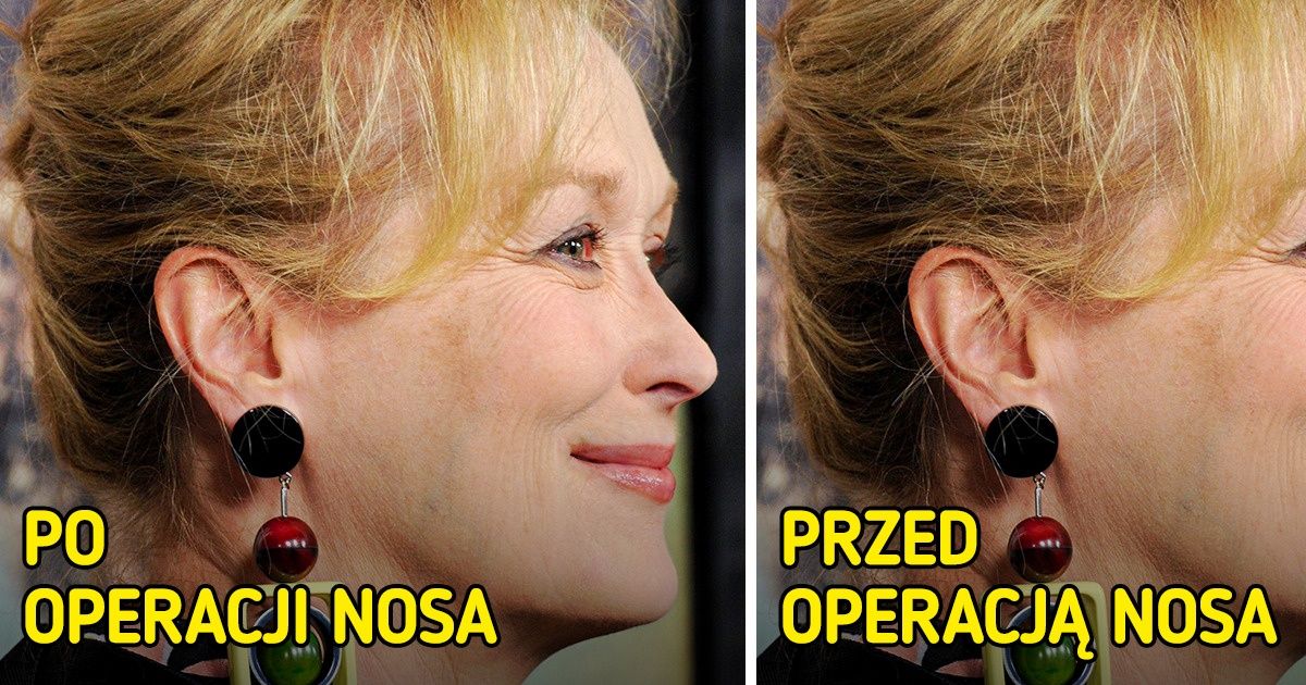 Jak wyglądałyby gwiazdy, gdyby poddały się popularnym zabiegom kosmetycznym Jak wyglądałyby gwiazdy, gdyby poddały się popularnym zabiegom kosmetycznym