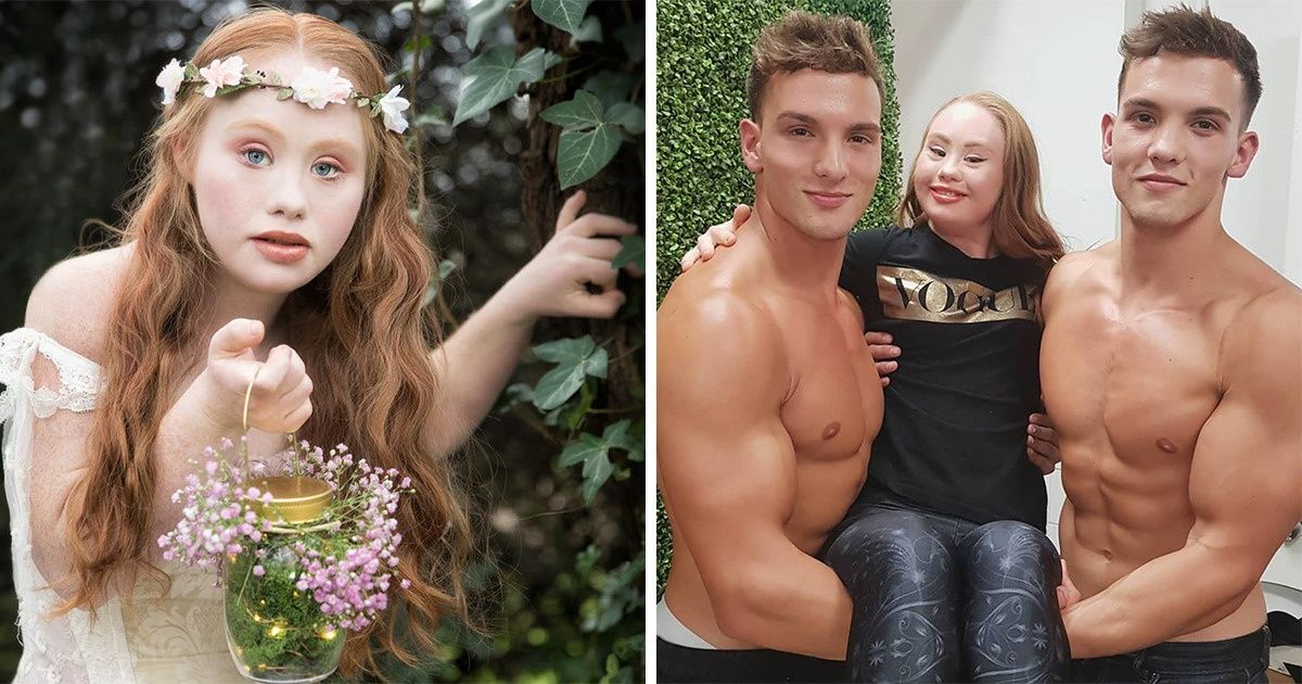 22-letnia modelka z zespołem Downa chce zostać Aniołkiem Victoria’s Secret i zmienić oblicze piękna