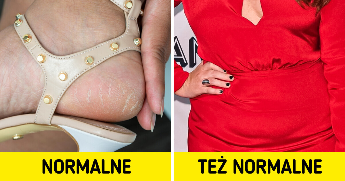 16 cech, które w dzisiejszych czasach definitywnie nie powinny być powodem do wstydu 16 cech, które w dzisiejszych czasach definitywnie nie powinny być powodem do wstydu