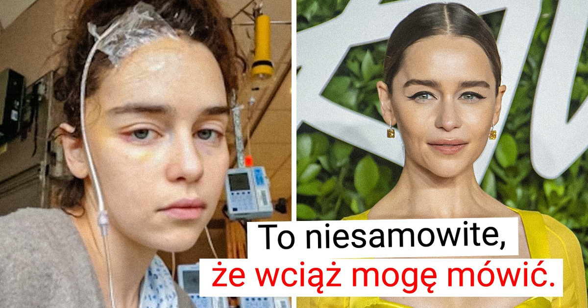 Emilia Clarke chce pomagać innym po tym, jak sama dwukrotnie musiała zmagać się z tętniakiem mózgu