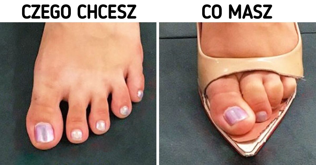Dlaczego tysiące kobiet rezygnuje z wysokich obcasów i zakłada trampki
