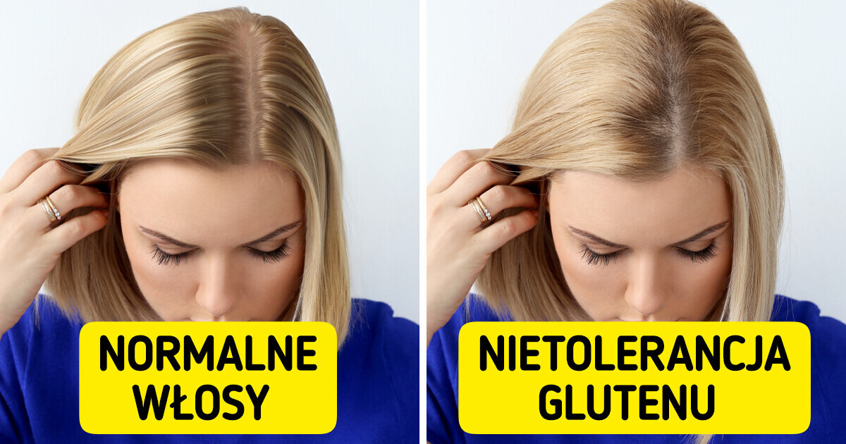 11 nietypowych oznak, że możesz mieć nietolerancję glutenu 11 nietypowych oznak, że możesz mieć nietolerancję glutenu