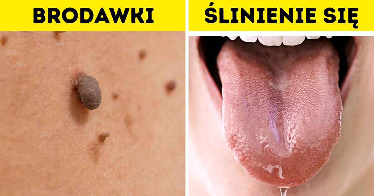 8 nietypowych oznak ciąży, o których mogłaś nie wiedzieć