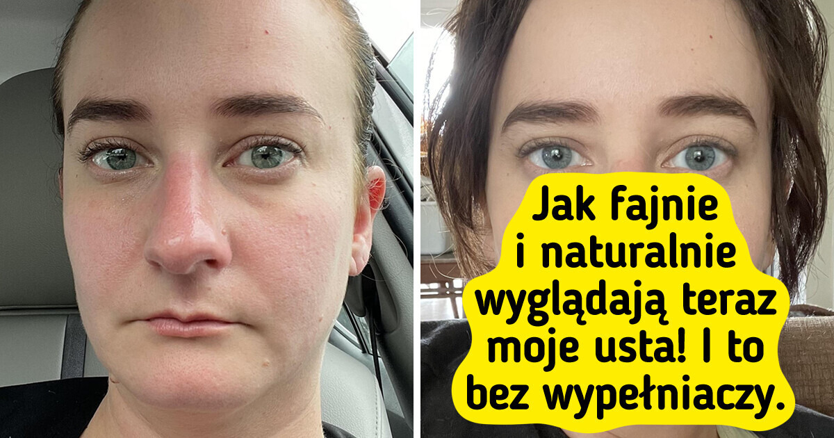 15 zestawień zdjęć, które pokazują niezwykłą zmianę na lepsze