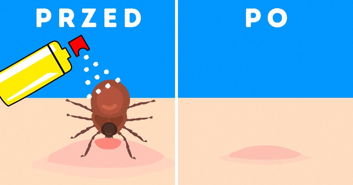 10 domowych sprayów na owady, które są równie skuteczne, jak te kupione w sklepie