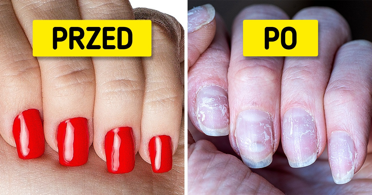7 sposobów, dzięki którym twoje paznokcie będą rosnąć mocniejsze i dłuższe