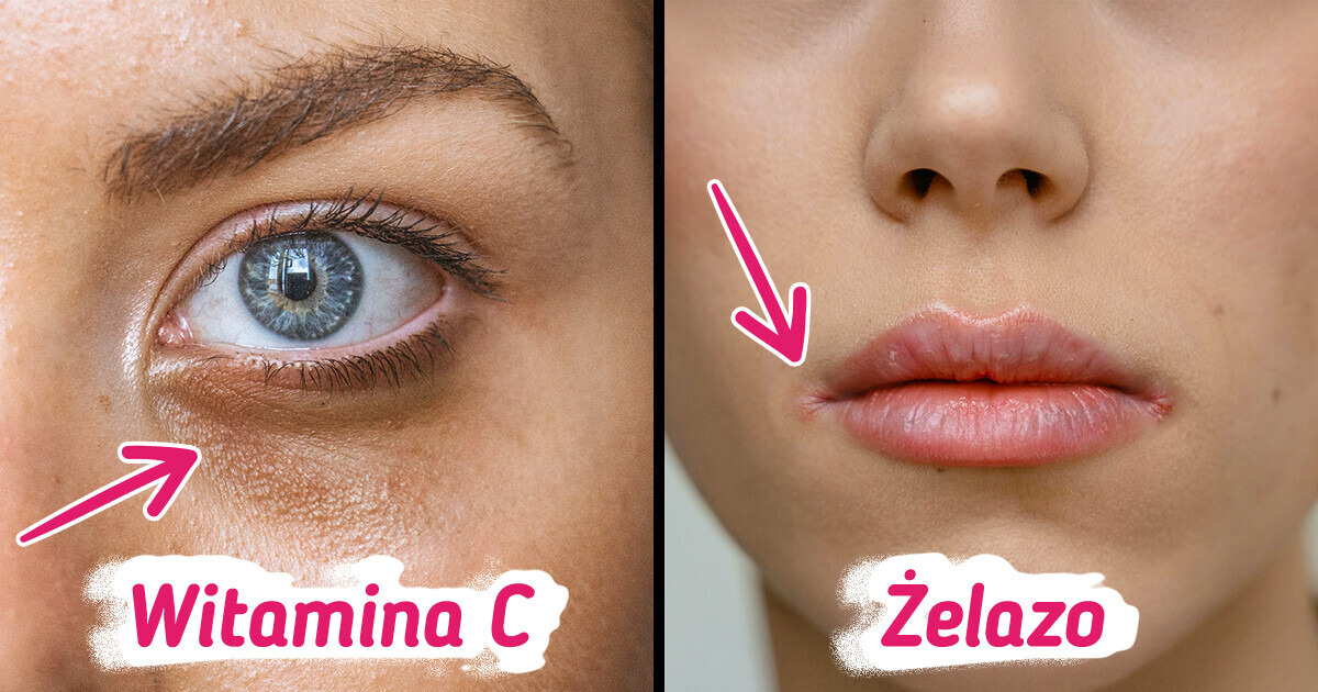 5 niedoborów składników odżywczych, które mogą odbierać kobietom ich naturalne piękno 5 niedoborów składników odżywczych, które mogą odbierać kobietom ich naturalne piękno
