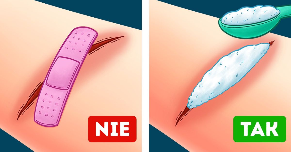 11 szybkich porad dotyczących pierwszej pomocy, które mogą cię uratować