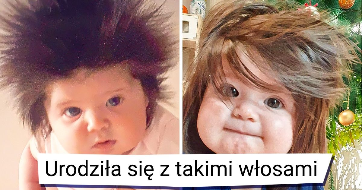 18 osób, które w darze od Matki Natury dostały coś ekstra