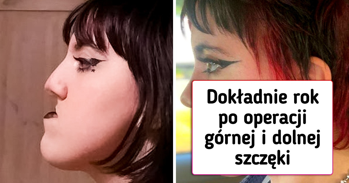 16 osób, które odważyły się poddać operacji plastycznej i wygrały los na loterii