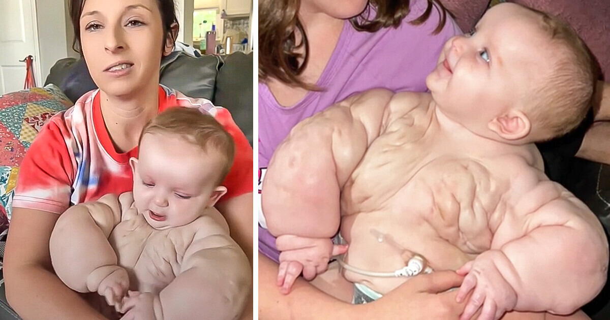 Poznajcie „Baby Hulka” — noworodka, który pokonał przeciwności losu