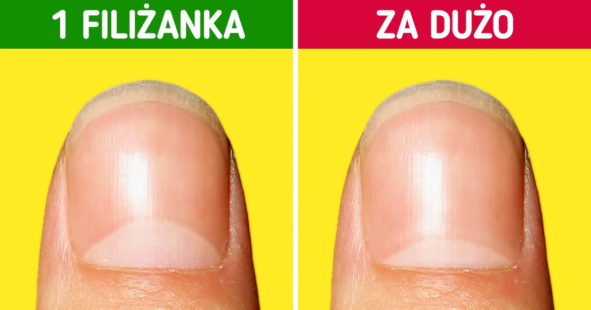 Co się stanie z twoim ciałem, jeśli będziesz pić za dużo kawy