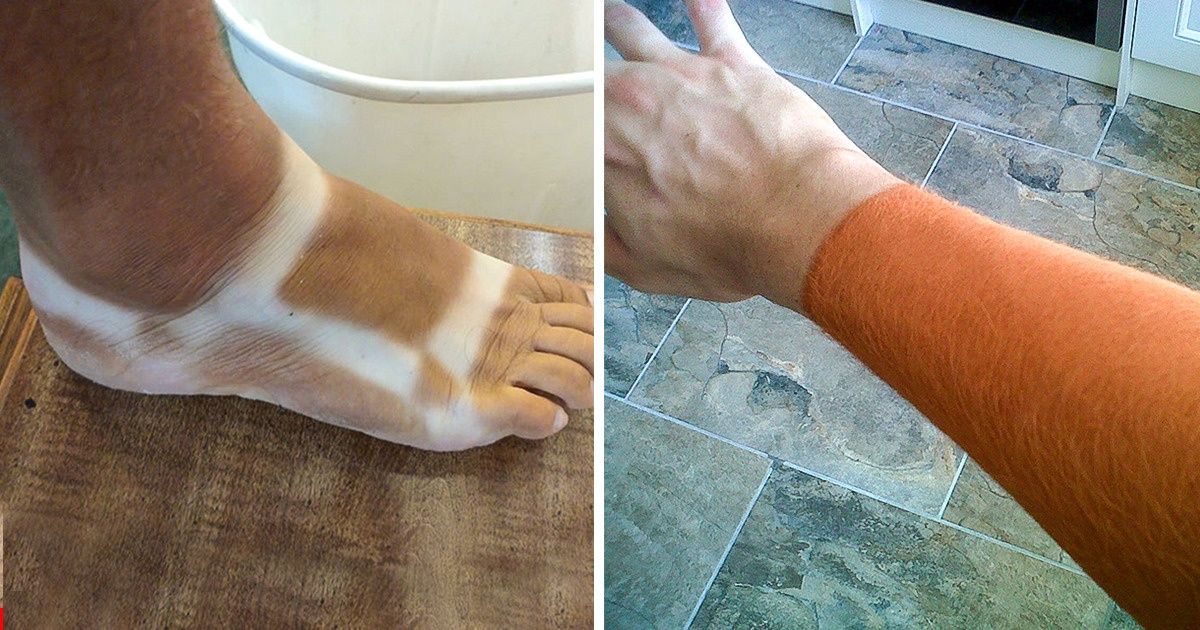 15 osób, które przesadziły z opalaniem i zostały „prawdziwie naznaczone”