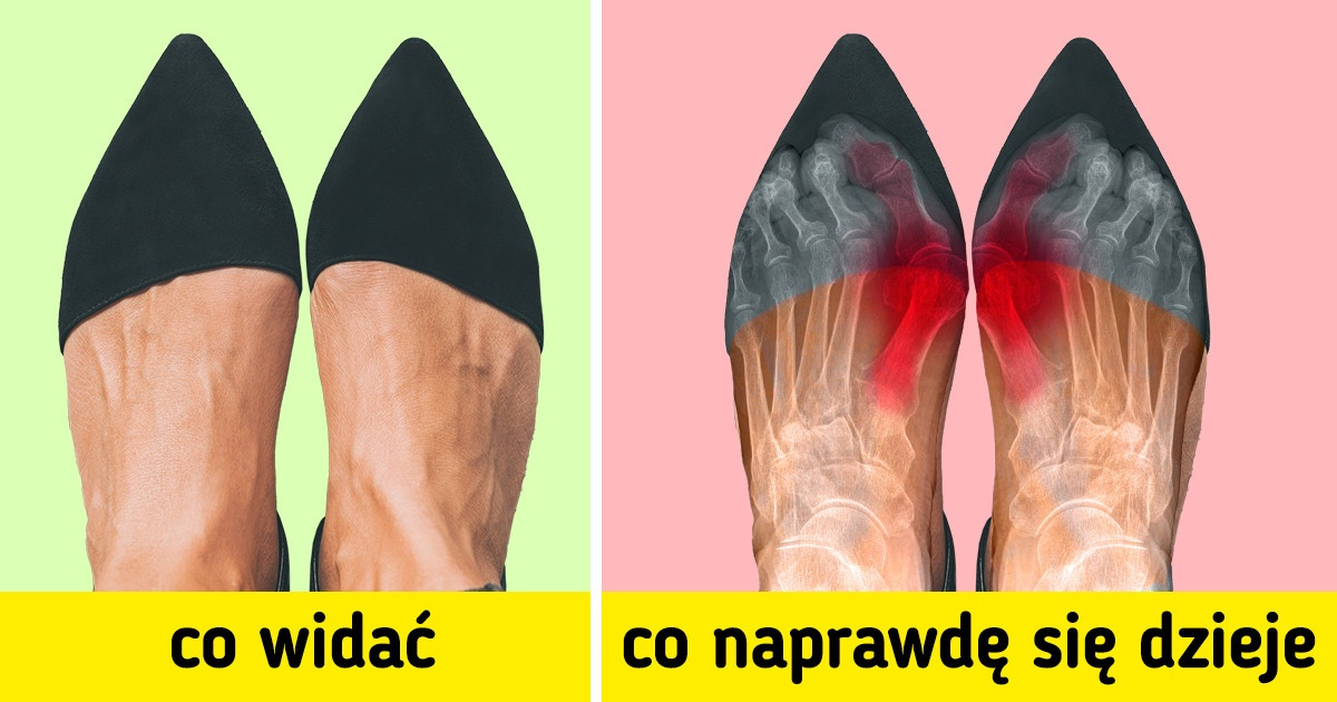 8 codziennych czynności, które w rzeczywistości nam szkodzą