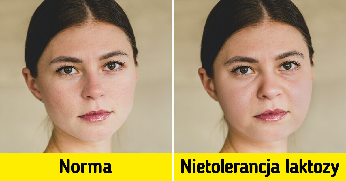 12 oznak, że możesz mieć nietolerancję laktozy 12 oznak, że możesz mieć nietolerancję laktozy
