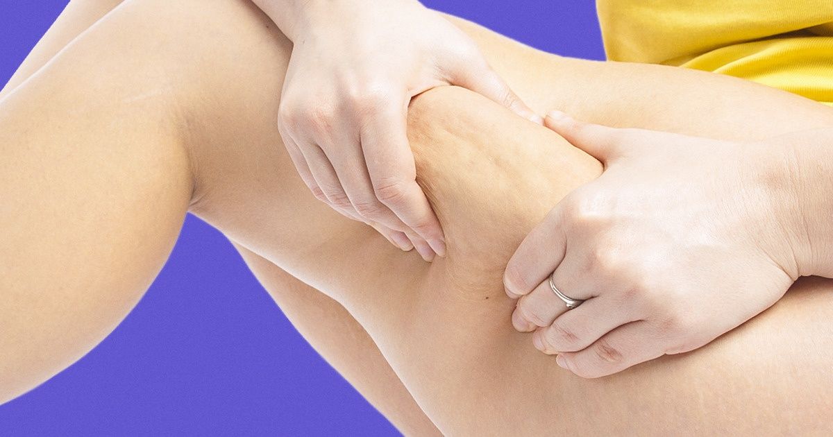 7 produktów żywnościowych, które pomogą ci zwalczyć cellulit 7 produktów żywnościowych, które pomogą ci zwalczyć cellulit