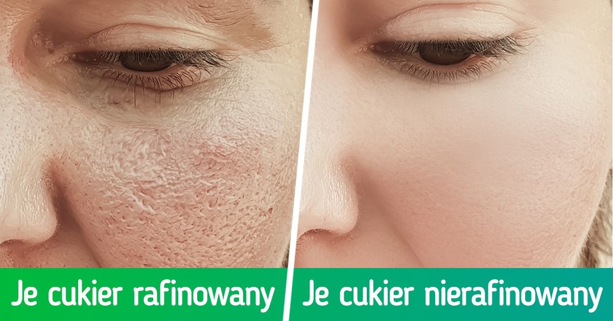 7 porad, które pomogą ci zmniejszyć pory