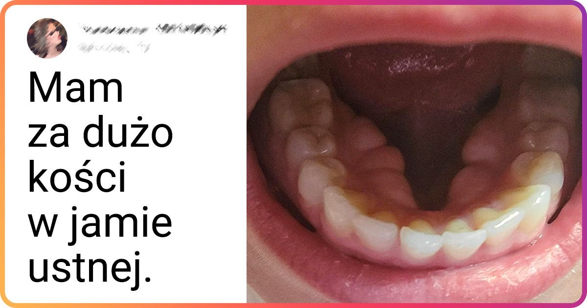 18 zagadkowych zdjęć, które pokazują ukrytą stronę zwykłych rzeczy