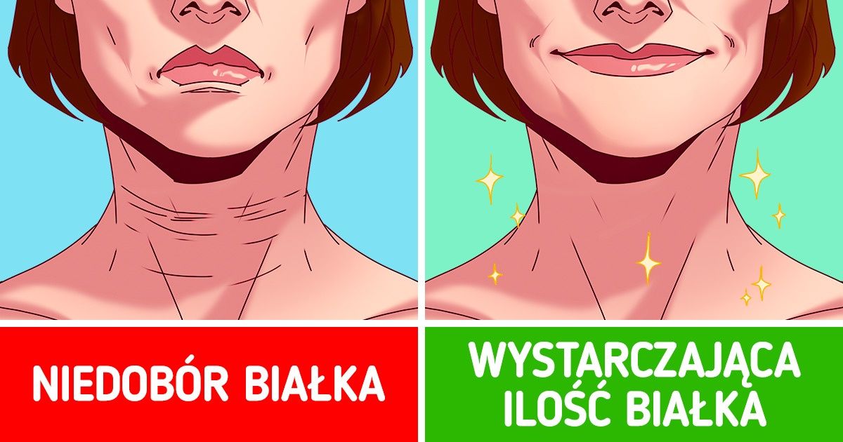 6 czynników, które mogą prowadzić do powstawania zmarszczek