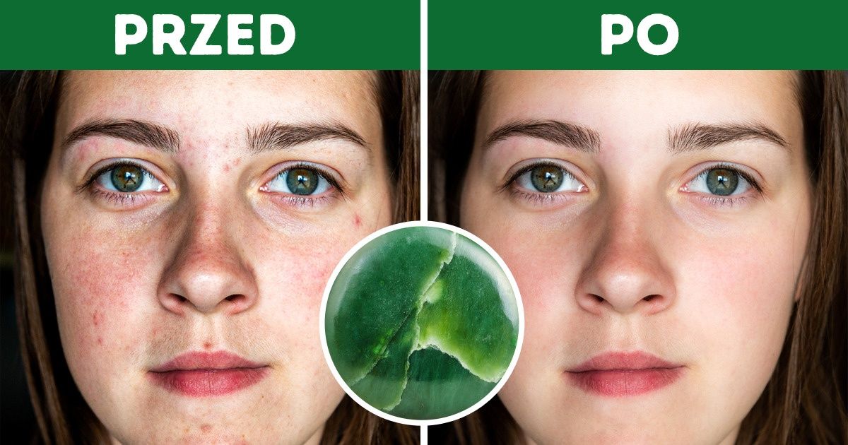 6 sposobów, w jakie wałek do twarzy może zmienić twoją skórę 6 sposobów, w jakie wałek do twarzy może zmienić twoją skórę