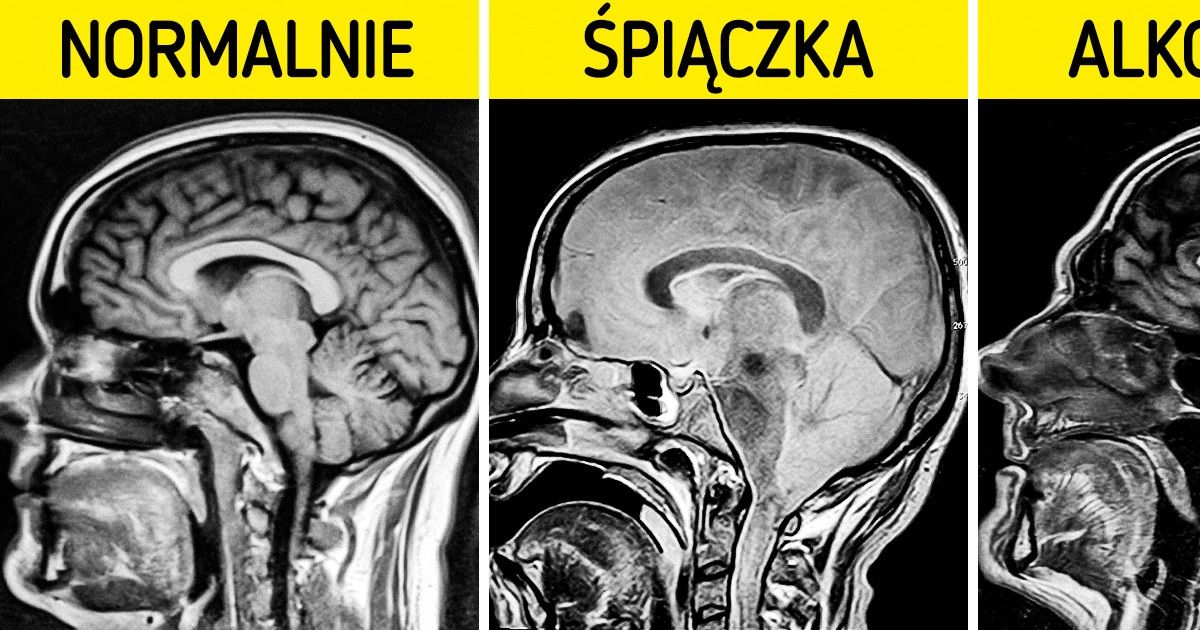 18 zdjęć rentgenowskich, które mówią o ciele więcej niż podręczniki do anatomii