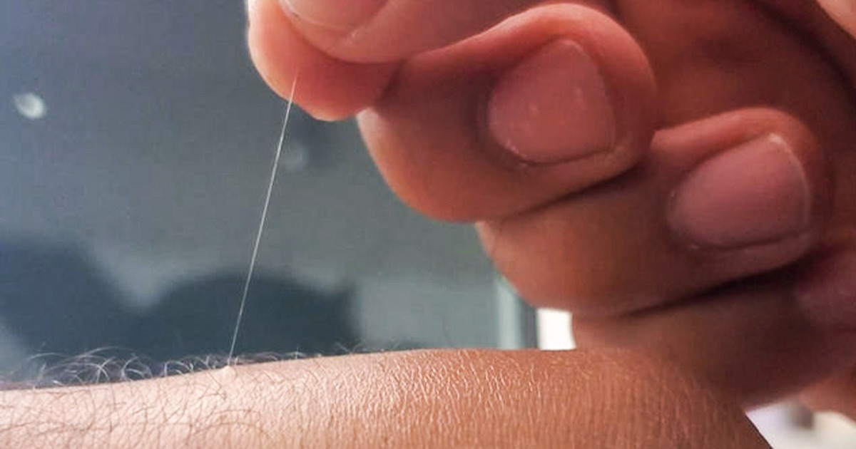 Dlaczego niektóre włoski na ciele osiągają absurdalną długość