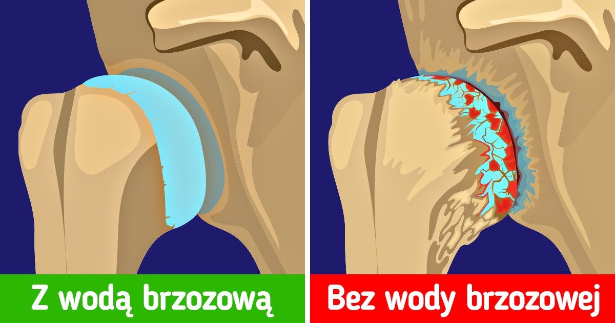10 napojów o cudownym wpływie na zdrowie