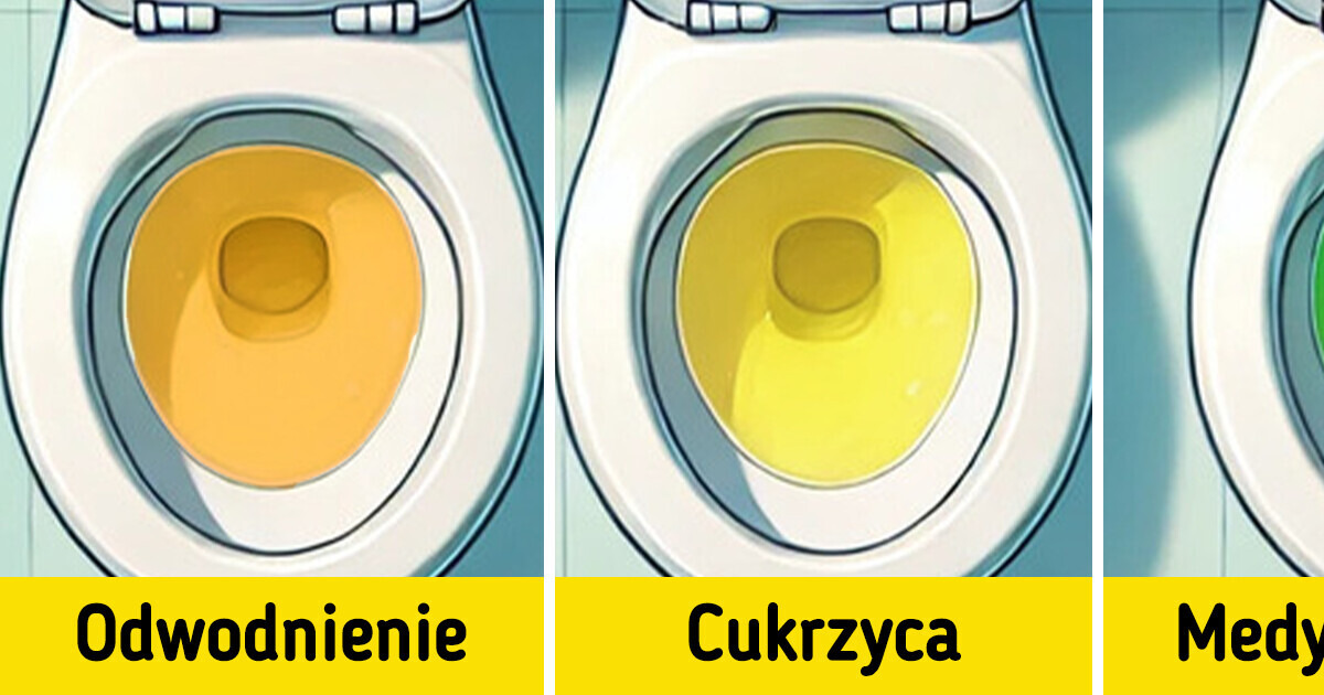 7 sygnałów ostrzegawczych dotyczących koloru moczu, które mogą wskazywać na problemy zdrowotne 7 sygnałów ostrzegawczych dotyczących koloru moczu, które mogą wskazywać na problemy zdrowotne