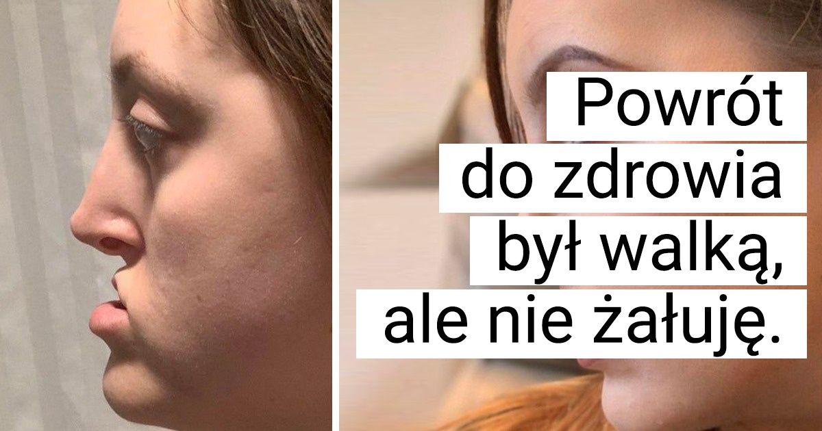 20 osób, które przeszły operacje plastyczne i olśniewają swoim nowym wyglądem