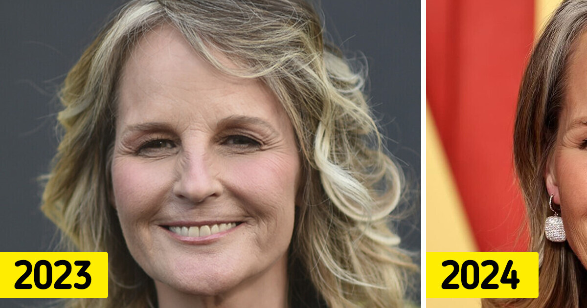 60-letnia Helen Hunt wprawiła internautów w osłupienie. Wszyscy mówią o jej ustach!