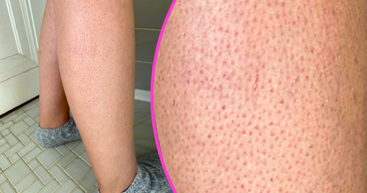 12 osobliwych cech ludzkiego ciała, którymi kobiety niepotrzebnie się martwią