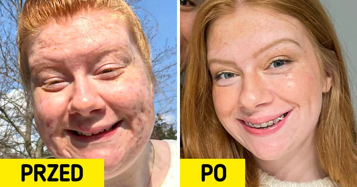 16 osób, które z dumą pokazują, jak zmieniły się przez lata