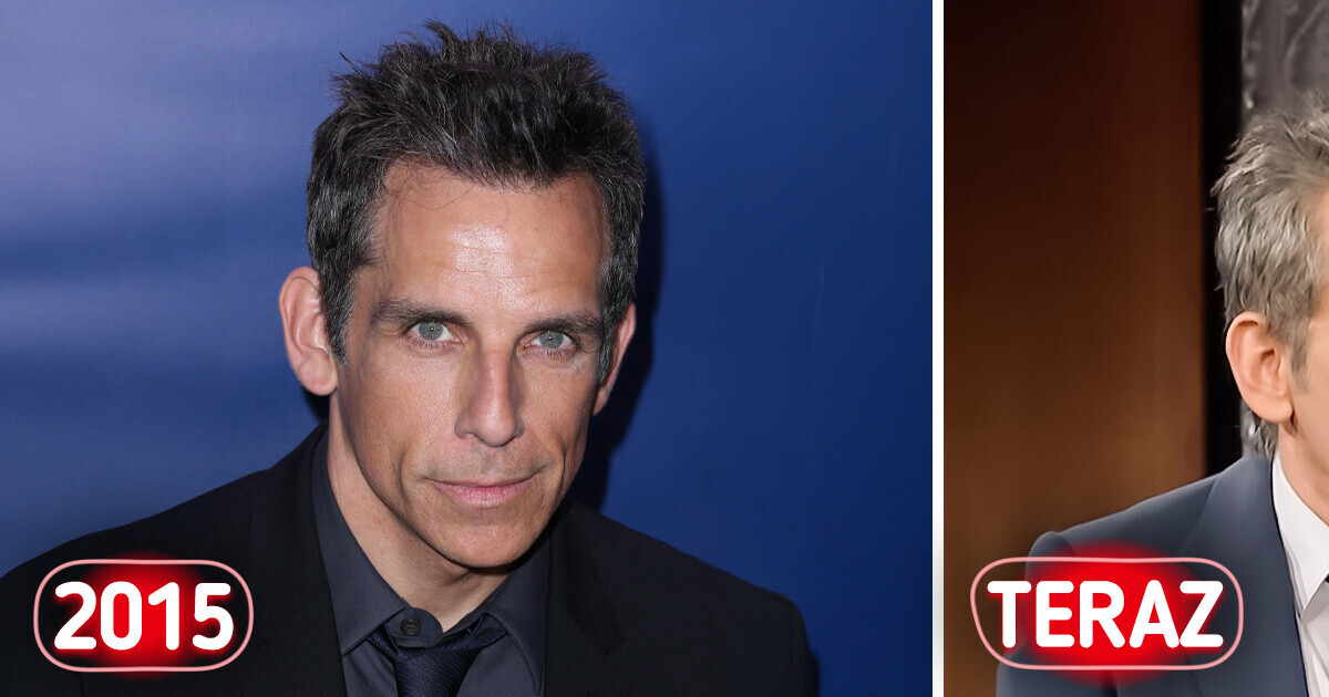 Ben Stiller (59 lat) wydaje się dużo starszy, niż zapamiętali go fani: „On wygląda na chorego” Ben Stiller (59 lat) wydaje się dużo starszy, niż zapamiętali go fani: „On wygląda na chorego”
