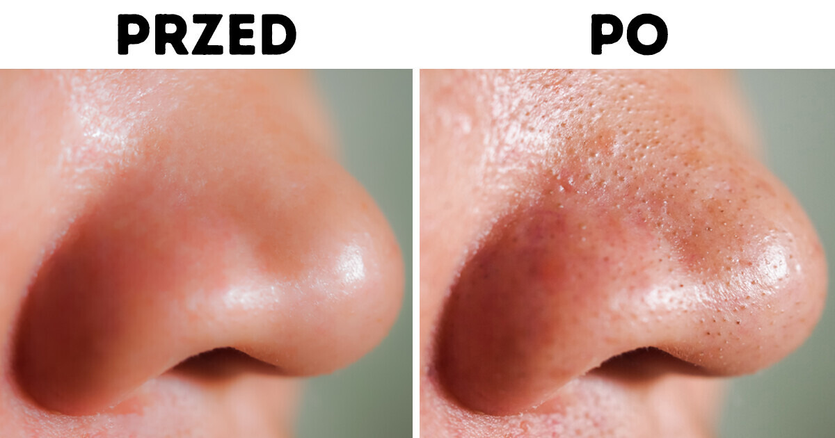 6 negatywnych efektów stosowania chusteczek do demakijażu