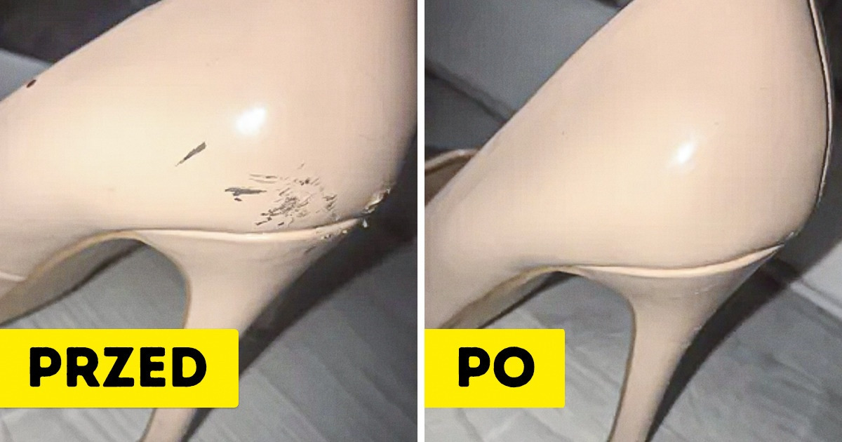 18 doskonałych sposobów na odzieżowe naprawy, którymi podzielili się internauci 18 doskonałych sposobów na odzieżowe naprawy, którymi podzielili się internauci