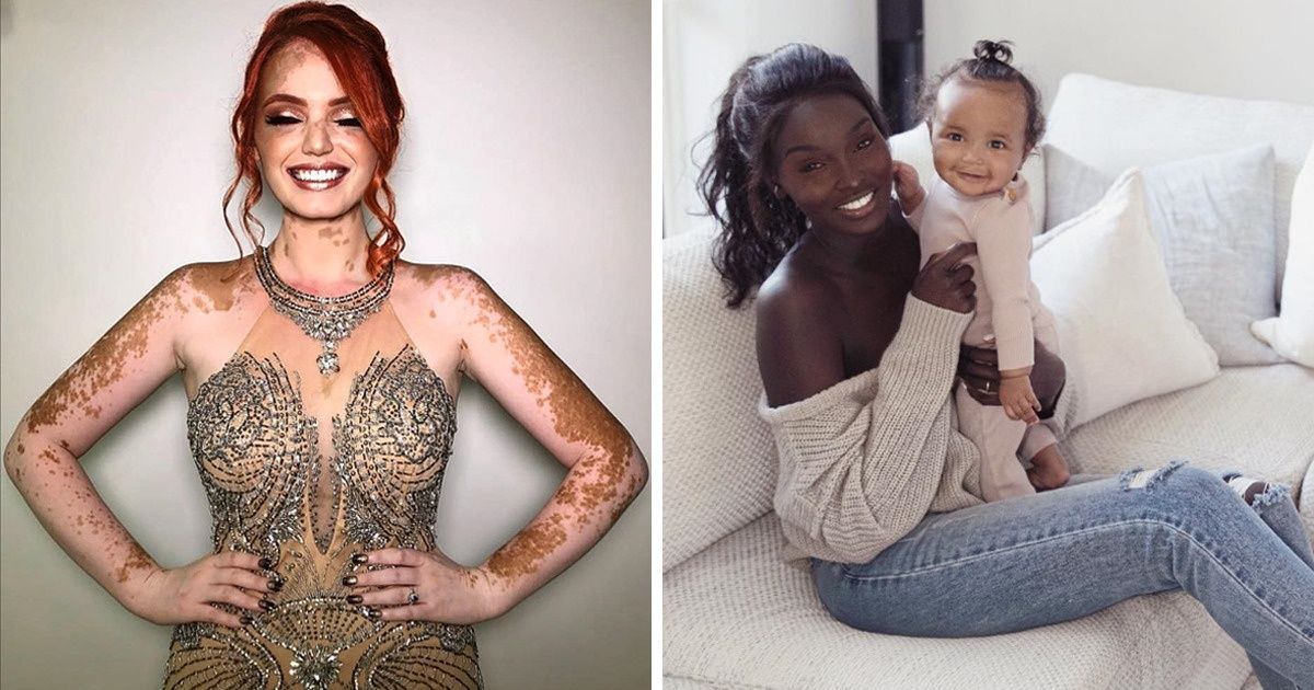 19 zdjęć z dumą ukazujących genetyczne arcydzieła, których nie widuje się codziennie 19 zdjęć z dumą ukazujących genetyczne arcydzieła, których nie widuje się codziennie