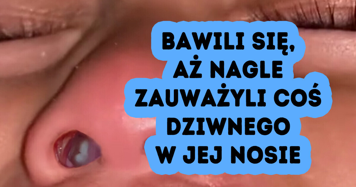 Matka znalazła w nosie córki coś, co sprawiło, że zaniemówiła