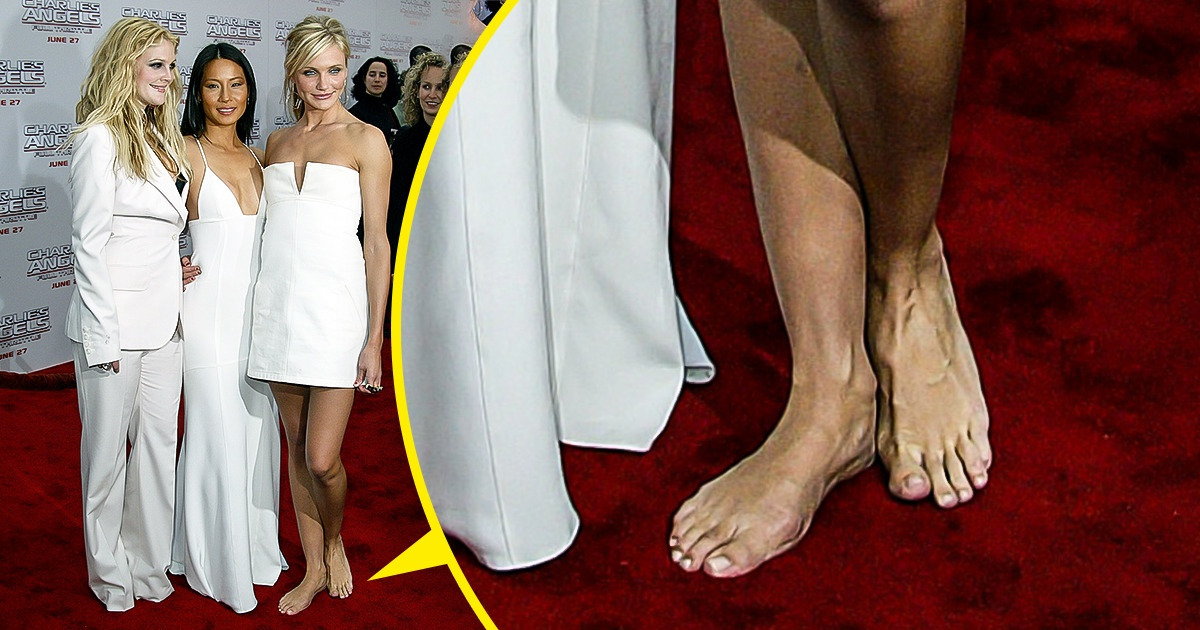 Trudno wymazać z pamięci te 8 niefortunnych wypadków, które przydarzyły się celebrytom Trudno wymazać z pamięci te 8 niefortunnych wypadków, które przydarzyły się celebrytom