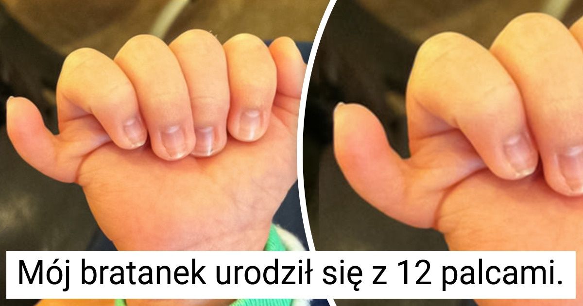 12 osób, które swoją wyjątkowością rozjaśniają świat