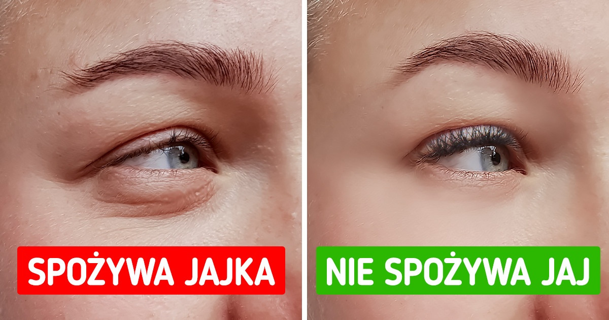 Co może się stać, jeśli przestaniesz jeść jajka? Co może się stać, jeśli przestaniesz jeść jajka?