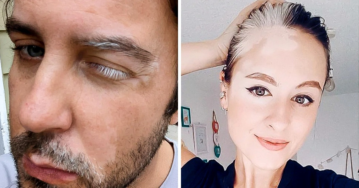 19 osób i zwierząt, których wyjątkowe cechy wyglądu czynią świat jeszcze bardziej zachwycającym miejscem